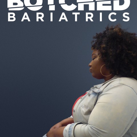 Botched Bariatrics